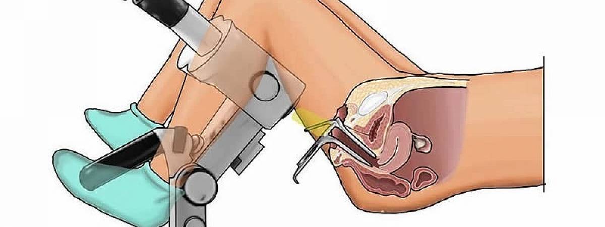 Старый гинеколог вставляет в вагину зрелой пышки специальный расширитель